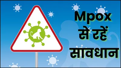 कोरोना की तरह mpox भी बदल रहा रूप  म्यूटेशन की रफ्तार देख वैज्ञानिक घबराए  क्या बढ़ेगा खतरा 