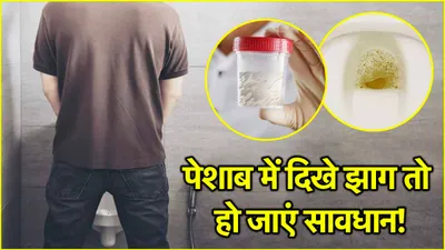 bubbles in urine  99  पुरुष नहीं जानते पेशाब में झाग आने का कारण  ये है गंभीर समस्या का संकेत  