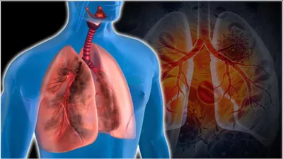 lung disease को बुलावा देती हैं ये 7 आदतें  धीरे धीरे शरीर पर ऐसे करती हैं हमला