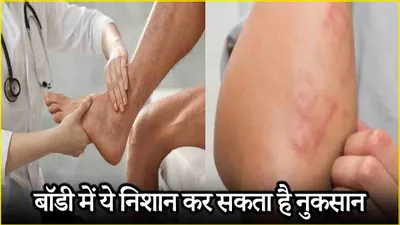 health tips  बॉडी में ये 5 लक्षण हो सकते हैं गंभीर बीमारी का कारण  हो जाएं सावधान