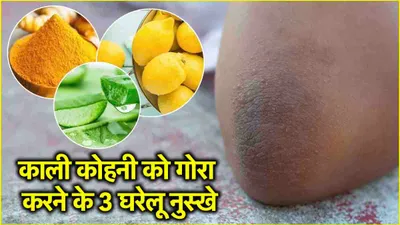 beauty tips  चुटकियों में करें कोहनी और घुटनों के कालेपन को दूर  अपनाएं ये 3 घरेलू नुस्खे