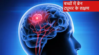 brain tumor  गेमिंग से 11 साल का मासूम हुआ ब्रेन ट्यूमर का शिकार  जानें कारण  लक्षण और बचाव