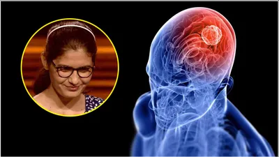 brain tumor से पीड़ित है kbc 16 की ये कंटेस्टेंट  जानें इस बीमारी के शुरुआती संकेत