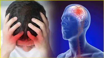 stroke causes  किस ब्लड ग्रुप के लोगों को ब्रेन स्ट्रोक का ज्यादा खतरा  शुरुआती संकेत और बचाव के उपाय