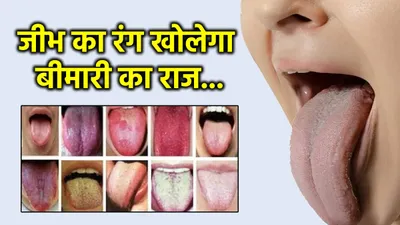 tongue colour  जीभ का रंग खोलेगा आपकी सेहत का राज  नीला रंग है खतरे का निशान