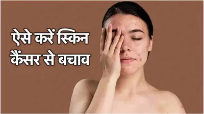 skin cancer  स्किन कैंसर से बचने के लिए सनस्क्रीन कितना फायदेमंद  अपनाएं ये आदतें