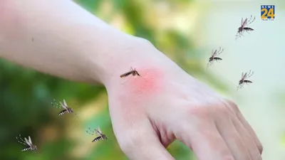 कुछ लोगों को कम तो कुछ को ज्यादा क्यों काटते हैं मच्छर  जानिए कारण और कैसे करें बचाव