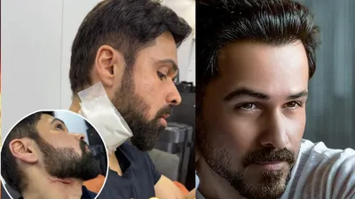 emraan hashmi को लगी गंभीर चोट  गर्दन से निकला खून