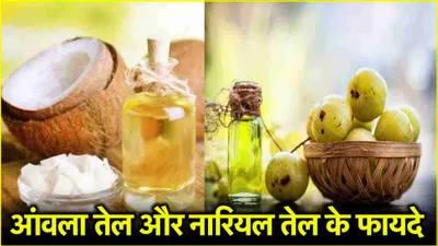 amla oil vs coconut oil  आंवला तेल या नारियल तेल कौन सा है बेहतर  जानें दोनों के फायदे