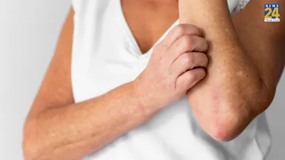 सामान्य एलर्जी भी बढ़ा सकती है skin cancer का खतरा  जानें कब सावधान रहने की जरूरत