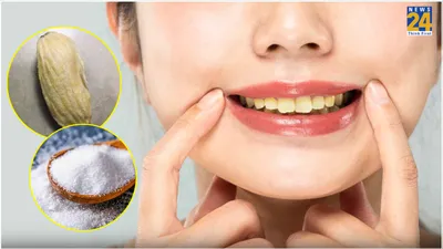 दांतों के पीलेपन को झट से दूर कर देगा आम का ये नुस्खा  ऐसे करें इस्तेमाल