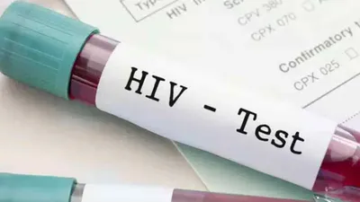 hiv पॉजिटिव युवती के  प्यार  में कैसे फंसे 20 लोग  खुद भी हुए पीड़ित  15 पत्नियां भी बीमार