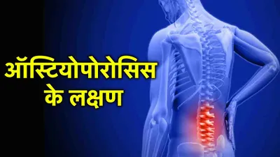 osteoporosis symptoms  ऑस्टियोपोरोसिस के 5 संकेत देखते ही जाएं डॉक्टर के पास  जाने कैसे करें पहचान 