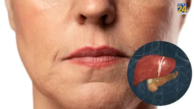 liver damage होने से पहले चेहरे पर दिखते हैं 5 संकेत