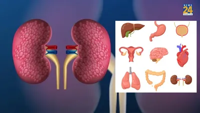 multiple organ failure क्या है  ये 8 संकेत भूलकर भी न करें इग्नोर