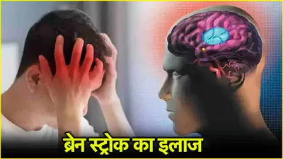 brain stroke के शुरुआती लक्षण क्या  कहीं आप तो नहीं कर रहे अनदेखा  क्या इलाज संभव 