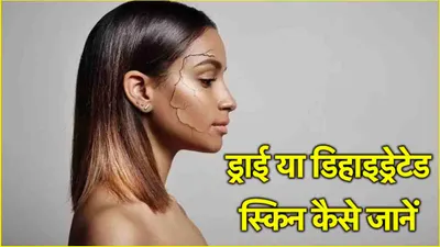 skin care tips  स्किन ड्राई है या डिहाइड्रेटेड  इन खास तरीकों से लगाएं पता  