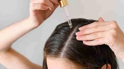 hair fall से हैं परेशान  3 होममेड सीरम करें ट्राय  नहीं टूटेंगे बाल