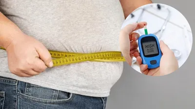 मोटापा कैसे बनता है इन गंभीर बीमारियों का खतरा  क्या कहते हैं हेल्थ एक्सपर्ट्स