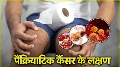 pancreas cancer symptoms  मल का रंग भी बता सकता है कैंसर है या नहीं 