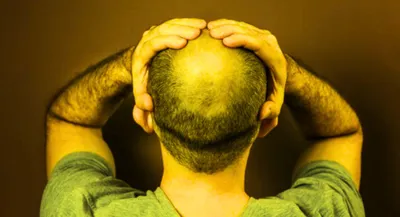 गंजे सिर पर जल्द उगेंगे बाल  वह भी नैचुरल तरीके से  वैज्ञानिकों ने ढूंढ़ा सिंपल इलाज